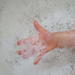 20210921 bad hand 20210921 bad hand